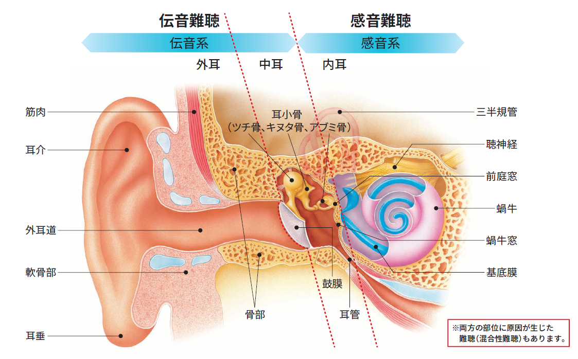 もっと知ろう 難聴の原因と特徴 知って欲しい 難聴者への接し方 スマート補聴器 デジタル補聴器 のリサウンド