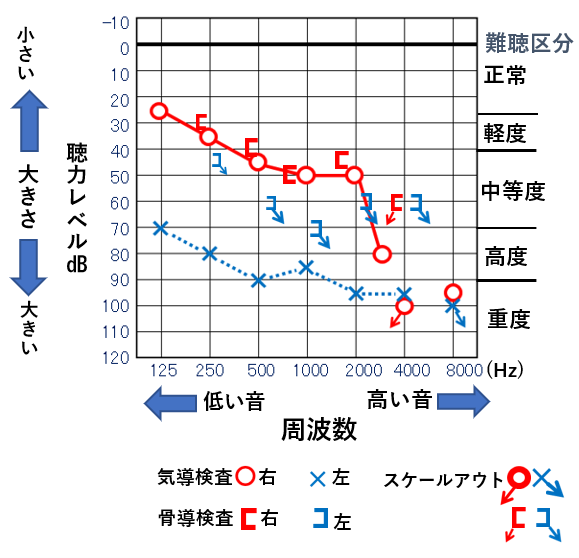 自分の聴力を知る オージオグラムを理解しよう スマート補聴器 デジタル補聴器 のリサウンド